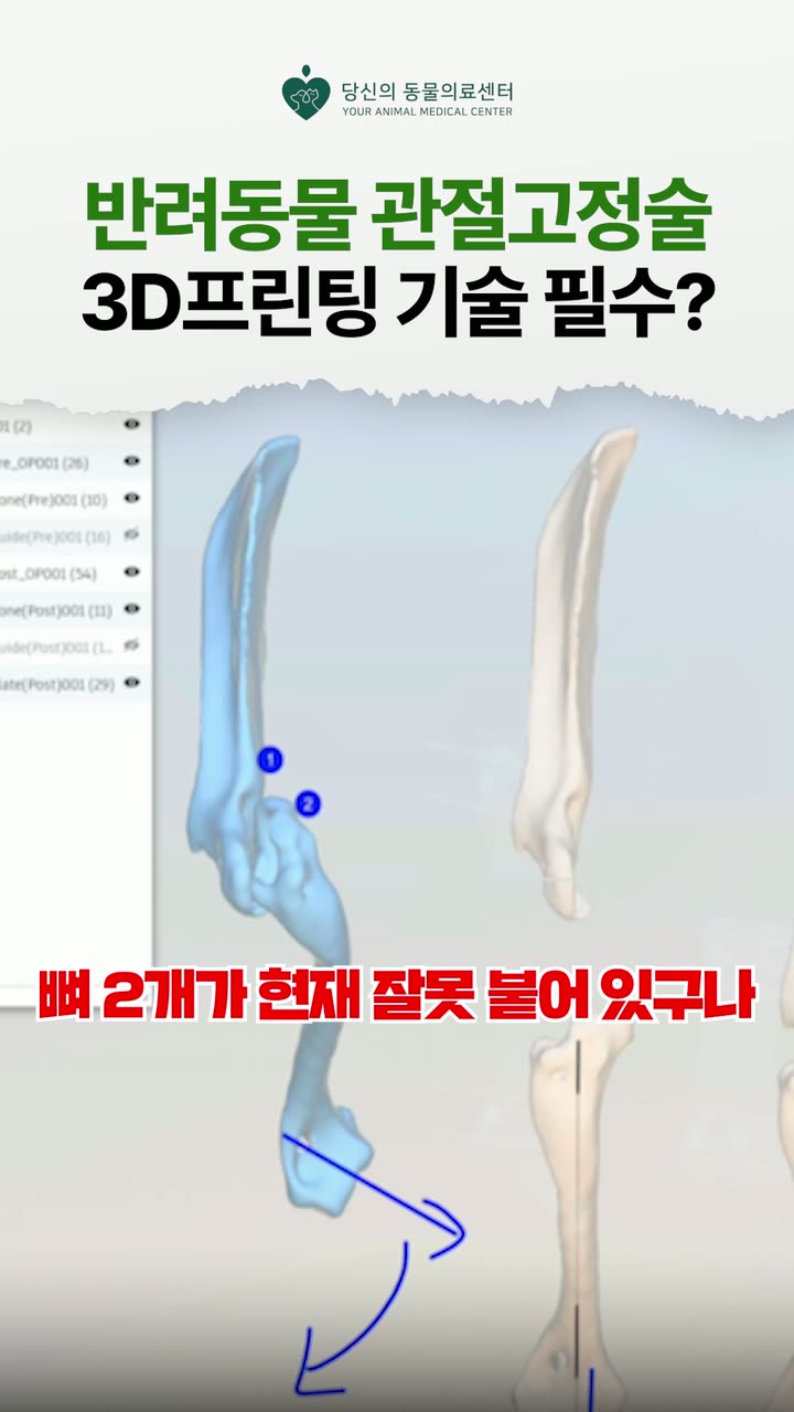 시리얼 진료 안내 쇼츠 — 병원·의료 쇼츠·릴스 편집 제작 사례